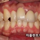차플란트치과의원 이미지