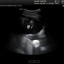 인정병원 화장실 이미지