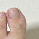발톱무좀관리 손톱영양제로 만족도 높았던 라셀턴 3개월차 후기