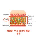올리브피부과의원 네이버블로그