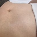 도솔로-2 | 대전온열돔다이어트 순환관리 에르벨에스테틱 괴정점 리얼후기