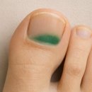 녹색정형외과의원 네이버블로그