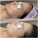 더벤티광주수완아름 | 수완지구피부관리 광주피부관리 수완지구리프팅 세이뷰티 만족후기