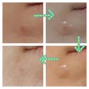 진메디케어 이미지