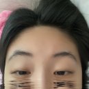 뉴라이프의원 네이버블로그