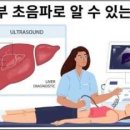 복부 초음파로 알 수 있는 것 이미지