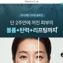 실톡스 리프팅 솔루션 후기 | 피부 탄력 리프팅 효과 2주 사용 솔직 리뷰