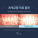 신흥부분정비 이미지