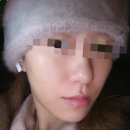 유정코피코주 | [피코프락셀 6회차 솔직후기] 프락셀고수의 찐사실과 꿀팁 8가지