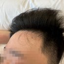알리오약국 | [푸켓 미슐랭]유명해서 가봤습니다. 서프앤터프(Surf &amp; Turf) 예약 및 솔직한 후기