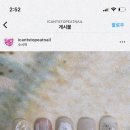 아캔스탑잇네일 이미지