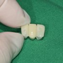 삼성치과기공소 이미지