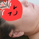 예린 더 스킨
