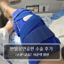 이춘택병원 | [수원 - 교동, 이춘택병원] 반월상연골판 수술 후기 (허준혁 부원장 - 봉합술)