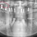 미켈란치과의원 이미지