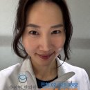 입꼬리 티스토리