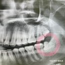 찬스플란트치과의원