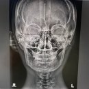 화인치과병원 | [첫 번째 교정일기] 교정치과 선정 기준