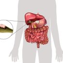 “이 사람들한텐 술 주지마세요” 소주 2~3잔만 먹어도 생존율 30% 미만의 암 걸리는 사람 이미지