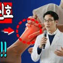 뇌경색 위험신호 이곳부터! 이미지