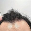 모모의원 | 오늘의 후기 모모성형외과의원