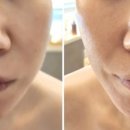 스킨보그 이미지