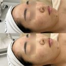 유일치과기공소 | 창원 피부관리 추천 유일한에스테틱/꼼꼼한 압출부터 모공 디톡스 케어까지!