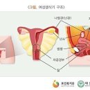 회사가 부담하는 질병으로 인한 경우에는 보상[﻿N88.3 : 자궁경부의 무력증, 자궁 근종] 이미지