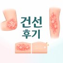 금정 | 대구중구건선 후기3명 / 금정구건선 후기3명 (무료샘플)