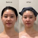 주식회사 스킨앤바디 | 내돈내산💰 #해운대피부관리 #레젤스킨앤바디 💆🏻‍♀️ #온d윤핏 리프팅 동안얼굴 리얼후기✨
