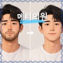 제모 성지, 메티의원 젠틀 맥스 프로 플러스 후기