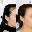 로만헤어 이미지