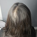 오투에스 | [두피페인팅] 수원두피커버잘하는곳 내가여성탈모라니? 진짜smp대만족 찐 후기