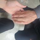 신세계 의수족 연구소 | 고난이도 손가락 의수 제작후기 (대구 의수족 전문, 서울 대전 대구 부산 광주 인천 울산)