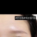 페이스라인(FACELINE)