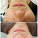 천안 RPC 이미지