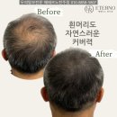 에테르노 | 전주두피문신 잘하는곳 에테르노전주점 내돈내산후기