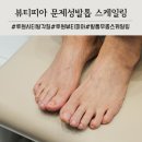 씨티샵 | 가정동 루원시티 문제성발톱 스케일링 전문샵 뷰티피아 발톱관리 후기