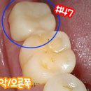 보일치과기공소 이미지