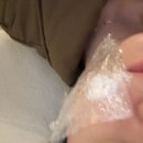 하늘체한의원 | 하늘체한의원 수원점 화상흉터 새살침 후기 / 강남언니 내돈내산