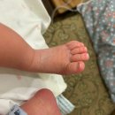 쉬즈산부인과의원 | 구미 쉬즈산부인과 둘째 제왕절개 입원 후기(4-6일차)