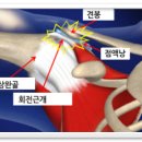 바디체인지체형교정 이미지