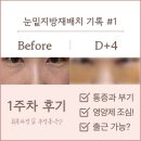자인동물병원 | [눈밑지#1] 눈밑지 통증으로 미라클모닝 하게 된 후기
