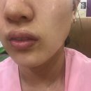 푸르지오세탁소 | 유성구피부관리, 장대동피부관리 나르시피아에서 회춘하고 왔어요