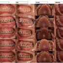 바른이예쁜이치과의원 이미지