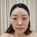 디또뷰티 | 보라매 에스테틱 디또뷰티 후기 예비신부 웨딩관리 받고 온 솔직후기