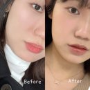 브이라인 리프팅 뷰티디바이스 추천 뷰앤디 앤모드 내돈내산 찐 후기 할인 구매 방법