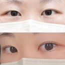 신림 속눈썹펌 신대방역 1인 래쉬샵 브로우마요 속눈썹펌 솔직후기