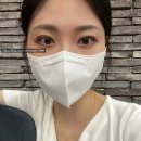 오렌즈오산점 | 성형은 신중하게,,,쌍수 한달차 후기 공유, 화장, 매몰쌍수 (인아웃라인, 자연유착)