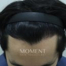 모먼트의원 이미지